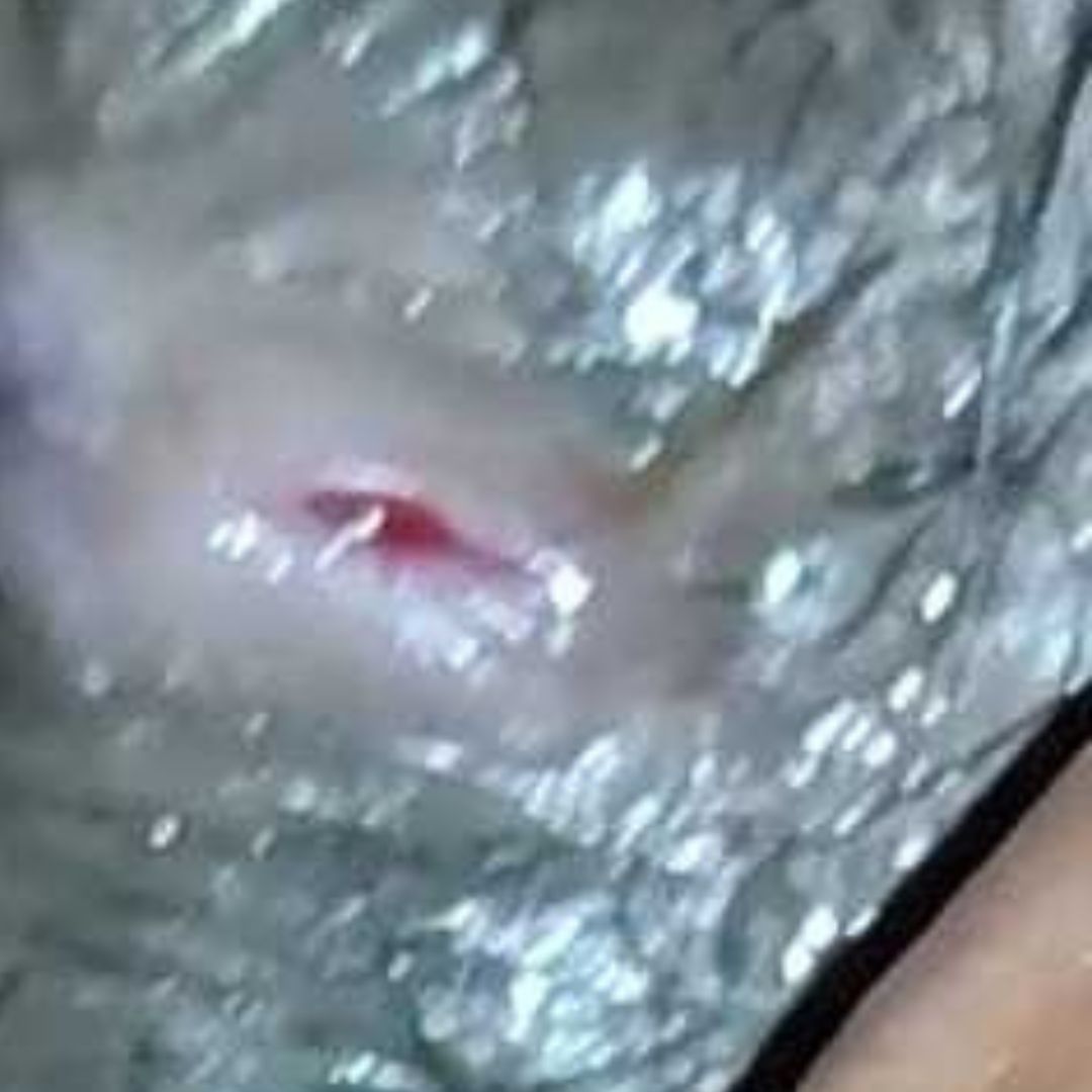 বার বার পুজ পরত, অপারেশনও করেছিলেন